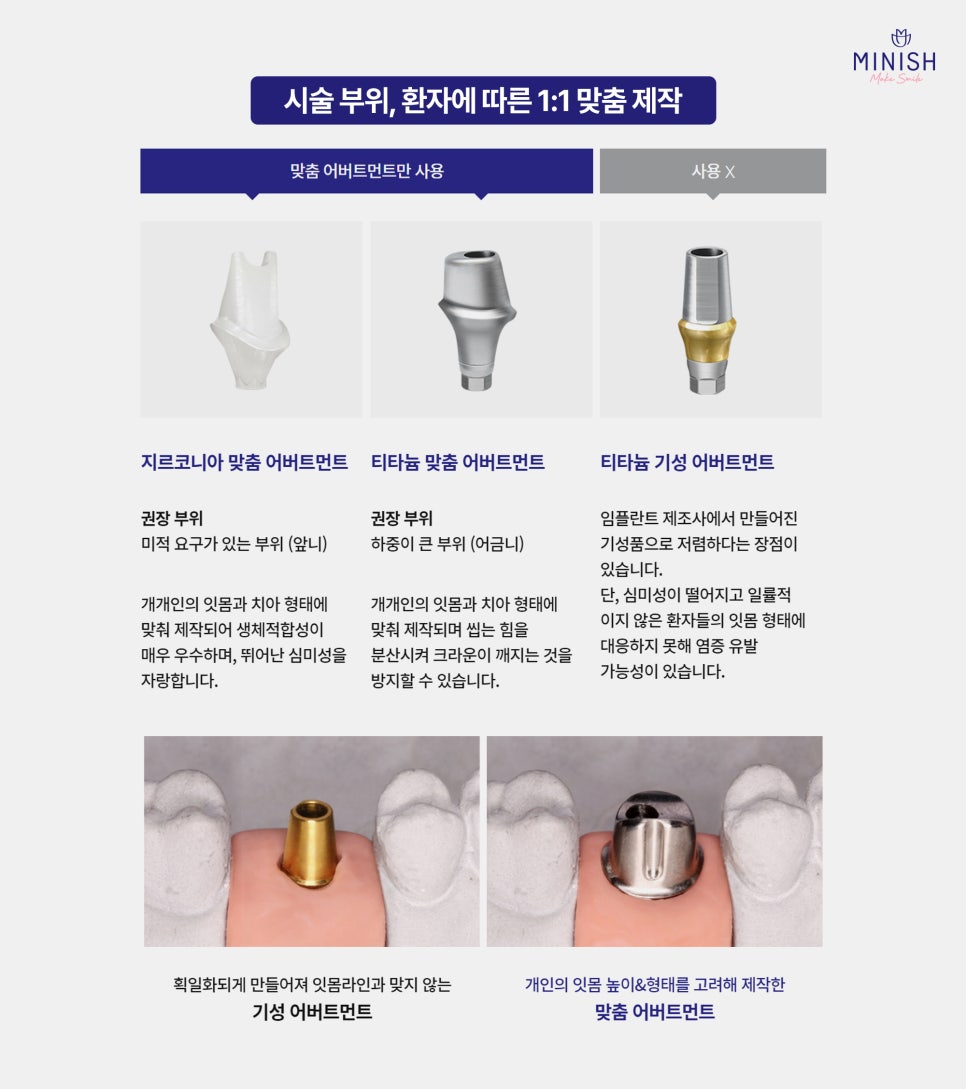 Implants, Only When Truly Necessary! Minish Dental Hospital’s Treatment Process for Protecting Natural Teeth image 7