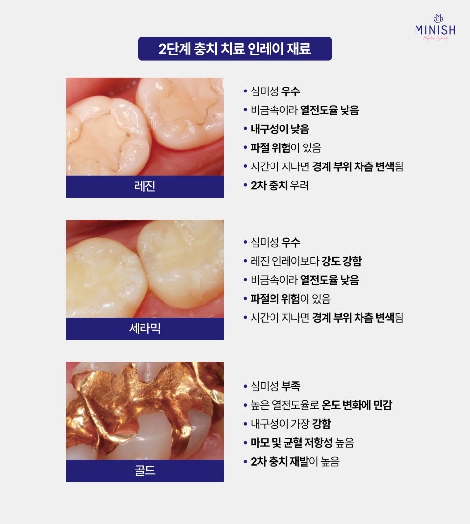 Caused by Cavities? A Complete Guide to Why Molars Break and How to Treat Them image 4