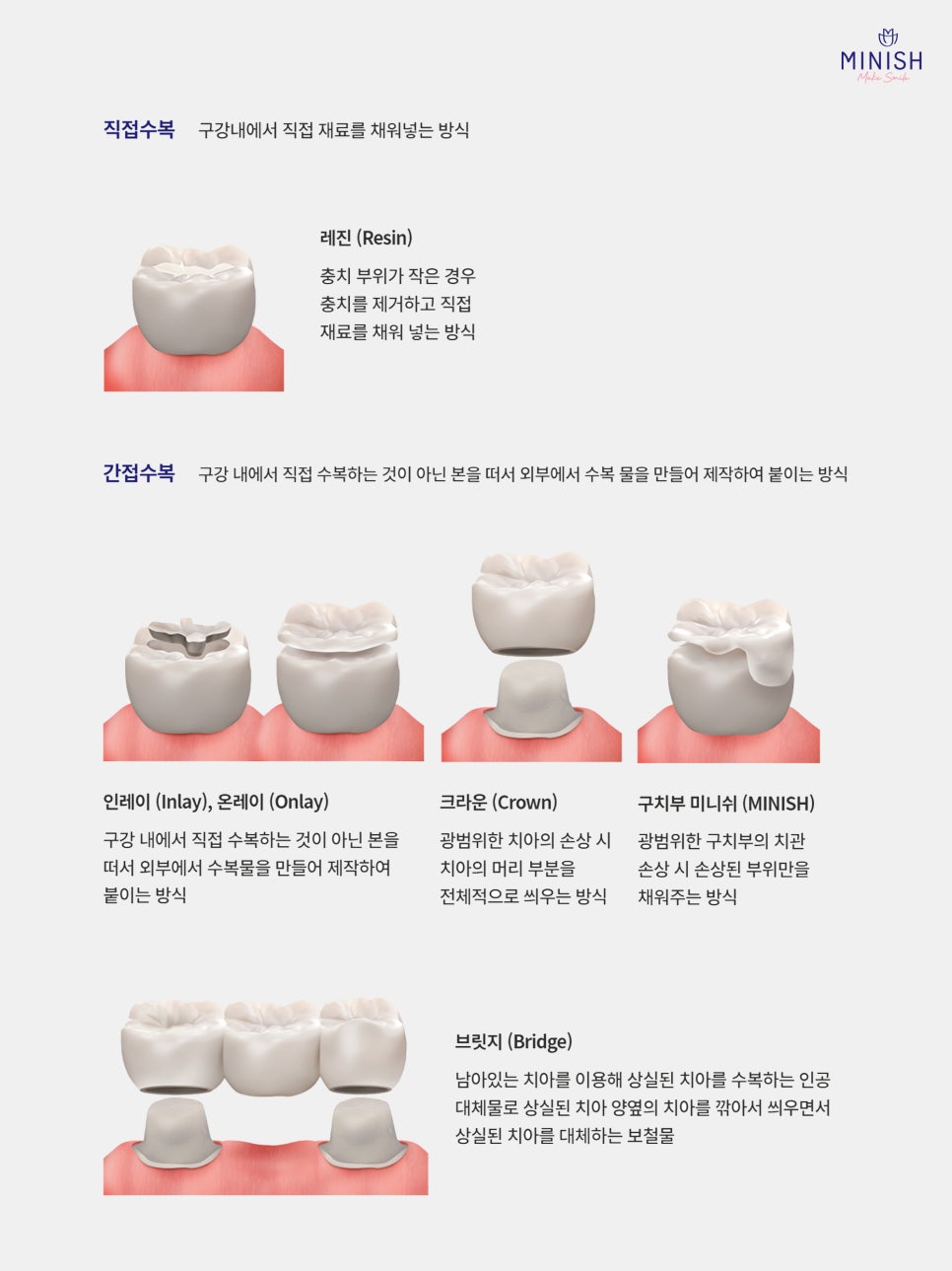 What Is the Best Way to Treat Cavities? What Is a Healthy Way to Protect My Teeth? image 3
