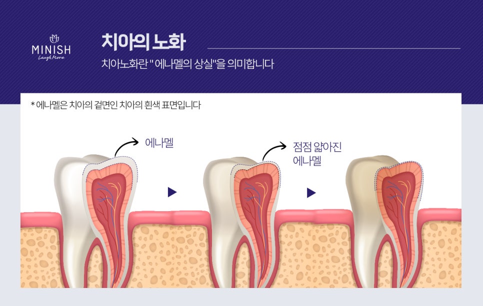 치아를 망치는 나쁜 습관? 치아 노화 막는 방법 관련 이미지 2