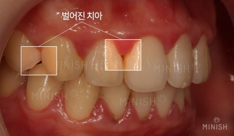 불행한 가정사를 딛고, 웃게 해준 관련 이미지 13