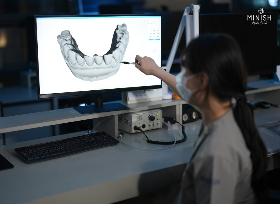 Minish One-Day System That Achieves Both Precision and Speed image 5