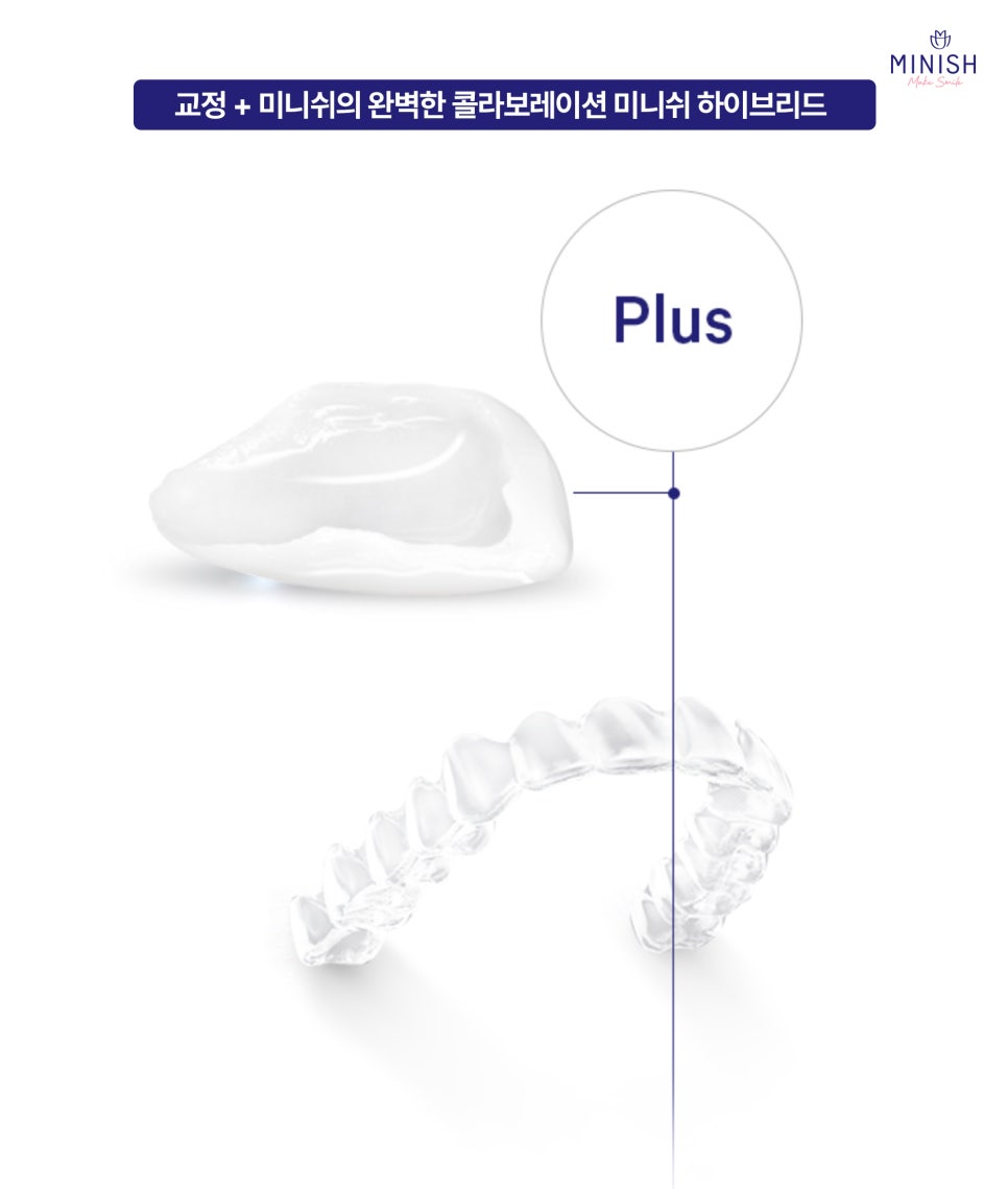 Types of Orthodontic Treatment at Minish Dental Hospital and How to Improve Aesthetics Too! image 7