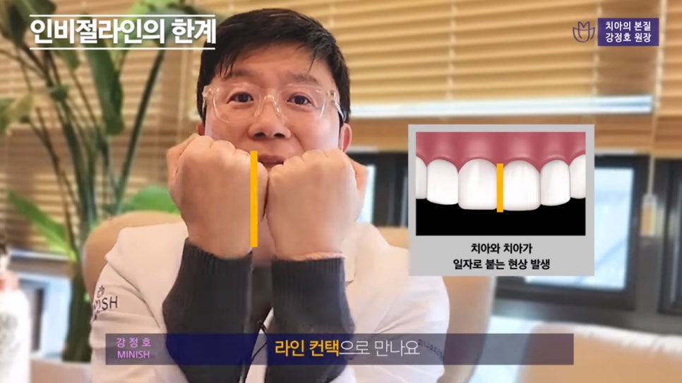 치아교정 앞둔 당신이 반드시 알아야 할 점① - 인비절라인 편 관련 이미지 8
