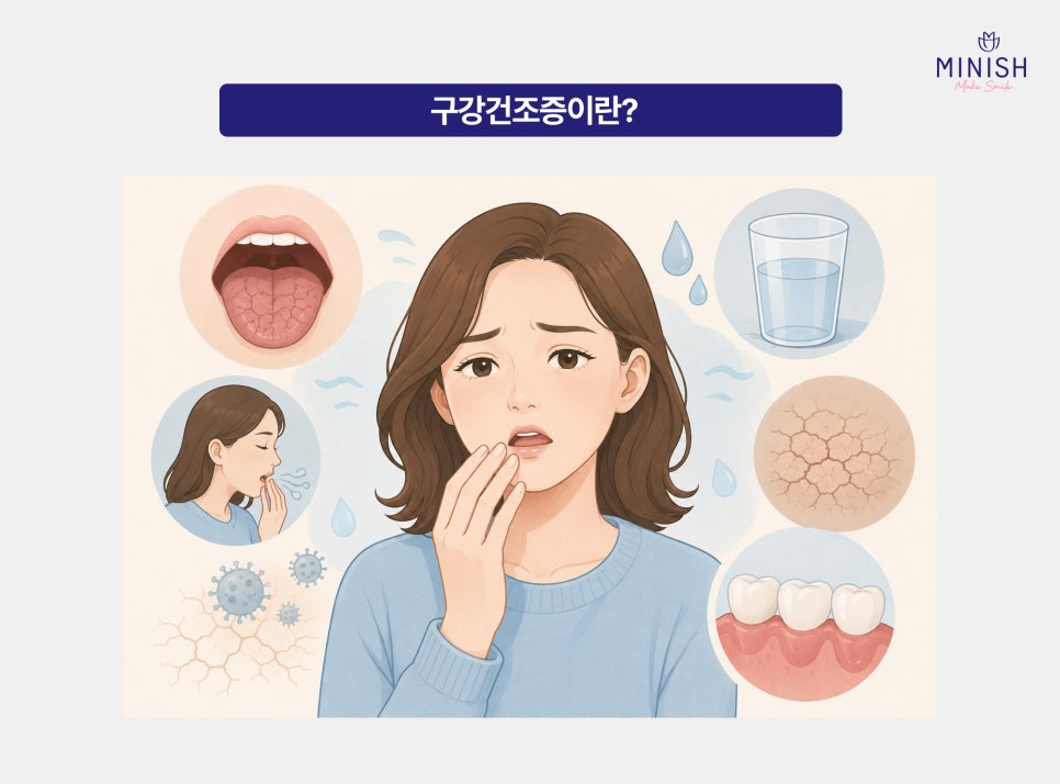 A Complete Guide to Dry Mouth: Causes, Symptoms, Treatment, and Choosing a Hospital image 2