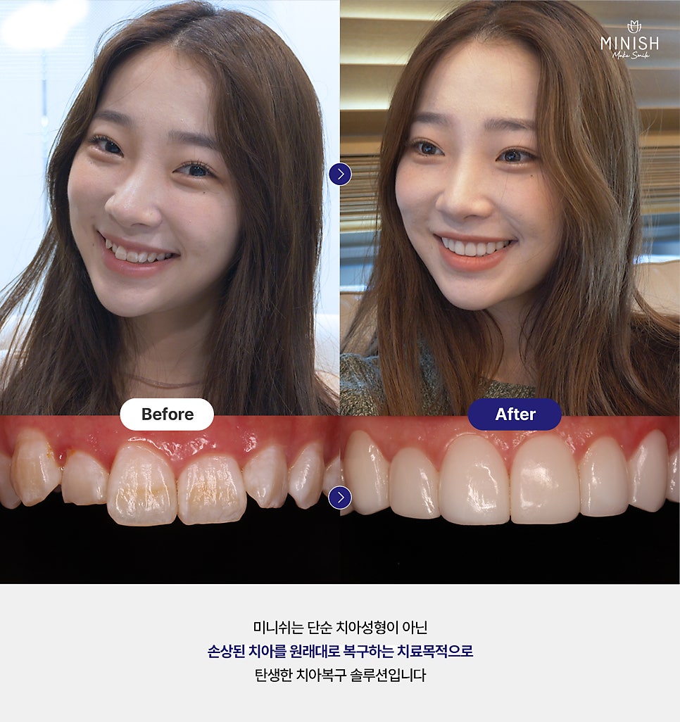 미니쉬와 라미네이트 차이점 총정리 관련 이미지 2