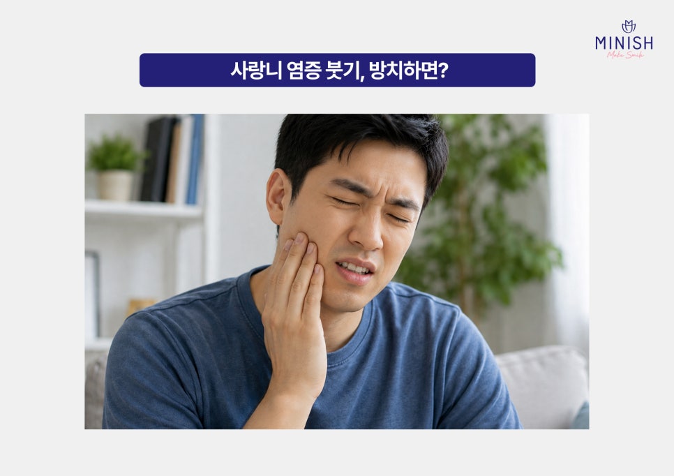사랑니 염증 붓기 고름 반복된다면? 발치 치료 시기 체크 관련 이미지 3