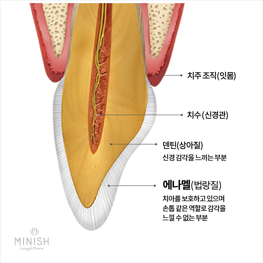 천안엄마의 치아노화, 미니쉬로 치아코팅하다 [엄마는예뻤다] 관련 이미지 8