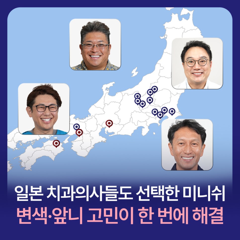 Minish Chosen by Japanese Dentists: Discoloration and Front Tooth Concerns Resolved at Once image 1