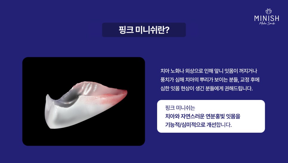 Gum Disease: Is It Just a Simple Problem? From Its Causes to Ways to Restore It image 5