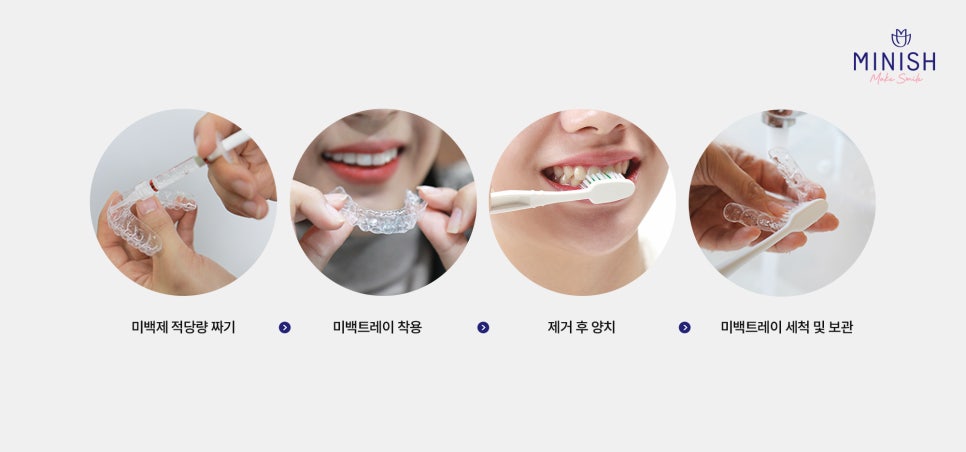 Yellow Teeth Concerns: Teeth Whitening Methods That Vary by Cause image 7