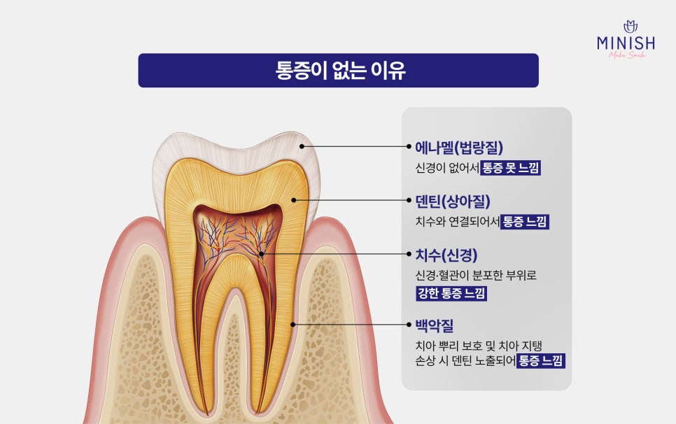 If You See a Black Spot on a Tooth, Is It Definitely a Cavity? image 3