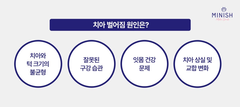 치아 벌어짐 왜 생길까요? 원인부터 치료 방법까지 관련 이미지 2