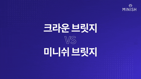 치아 브릿지, 자연치아를 보존하는 미니쉬 브릿지 관련 이미지 3