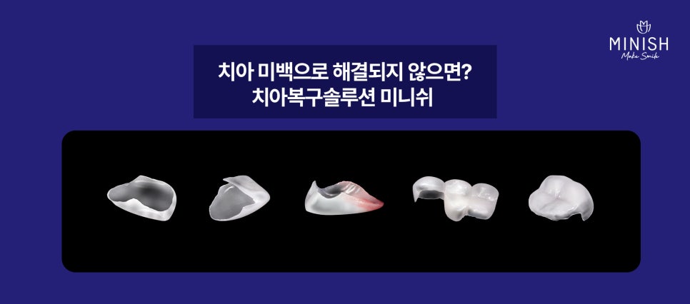 Yellow Teeth Concerns: Teeth Whitening Methods That Vary by Cause image 17
