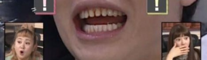 What’s the Difference Between Cosmetic Veneers and Treatment-Oriented Minishe? image 2