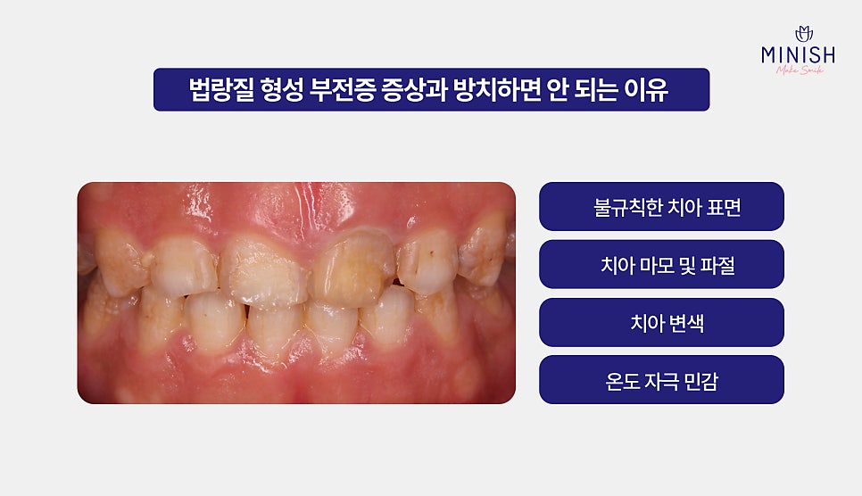 [Amelogenesis Imperfecta] If Your Teeth Wear Down and Break Easily, What Are the Treatment Options? Complete Guide image 3