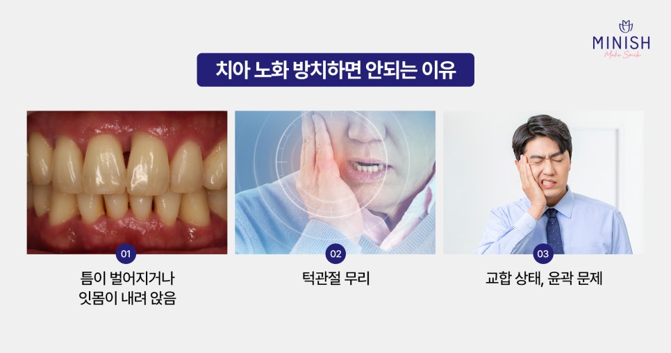 [Tooth Anti-Aging] If your teeth are worn down and sensitive, can Minish help you regain healthy teeth? image 3