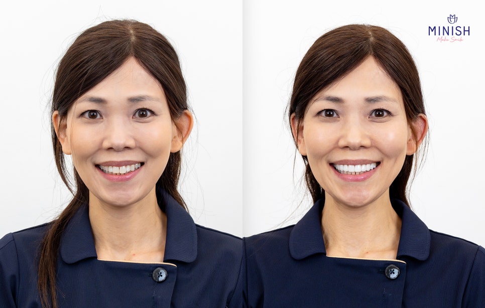 A 26-Year Veteran Japanese Dentist Was Also Surprised by Minish — It Felt Different When I Tried It Myself image 3