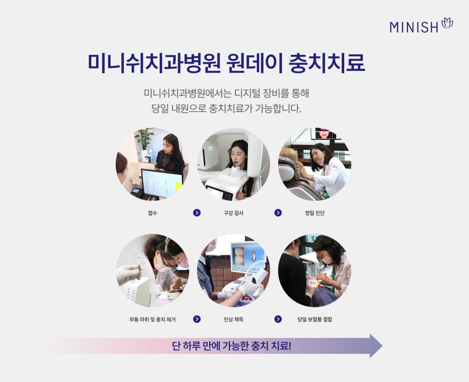 충치 단계별 치료 방법, 원데이 치료로 하루 만에 가능할까? 관련 이미지 9