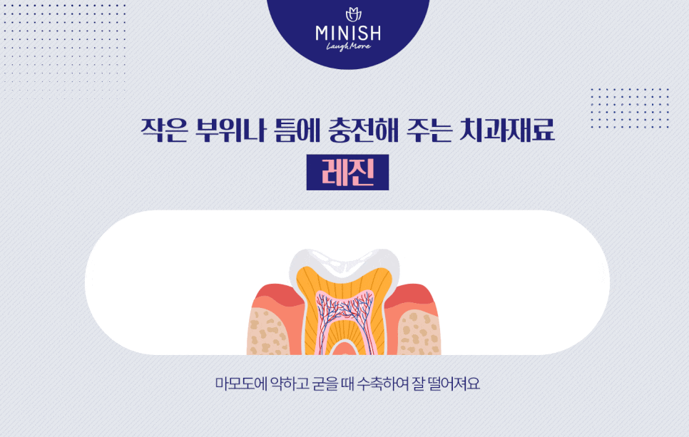치아 수명 연장하는 법 관련 이미지 5