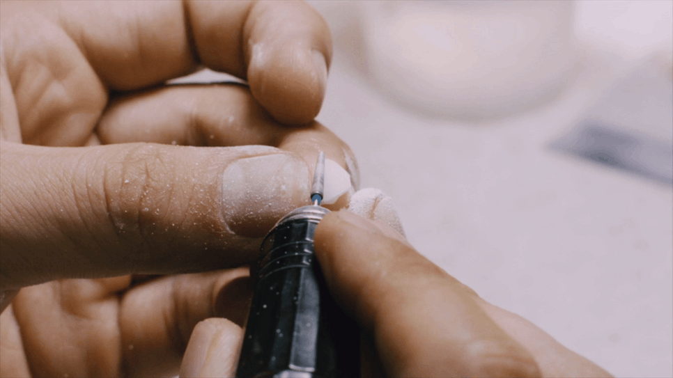 When Crown Retreatment Is Needed: The Tooth Restoration Solution Minish image 4