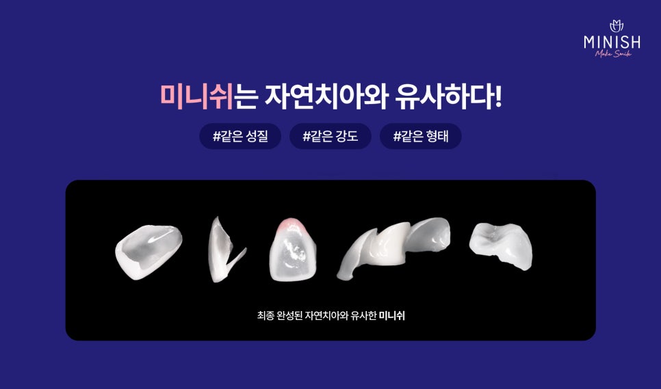 Why You Shouldn’t Leave Crooked Teeth Untreated? A Way to Improve Them in Just One Day! image 5