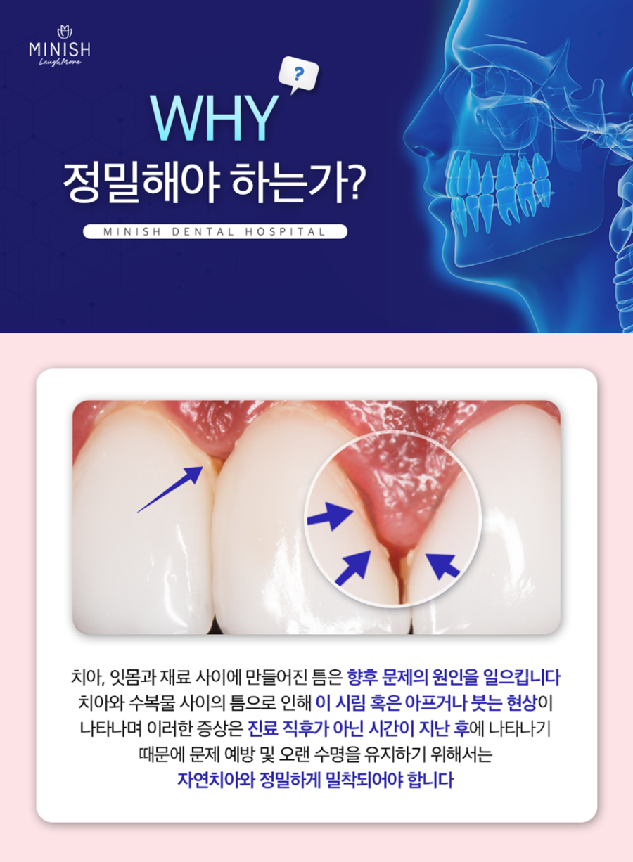 논현동치과 아름다운 미소와 함께 되찾은 자신감 관련 이미지 3