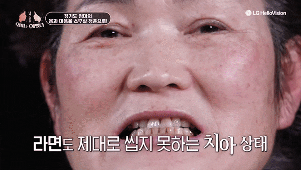 [Tooth Aging] Do Teeth Age, Too? Restoring Them Healthily with Minishe image 9