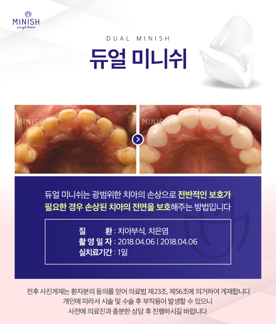 신논현역치과 치아 건강과 아름다움을 오래 유지하고 싶다면 관련 이미지 5