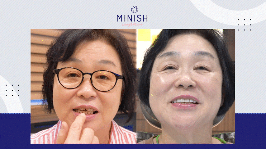 치아 수명 연장하는 법 관련 이미지 8