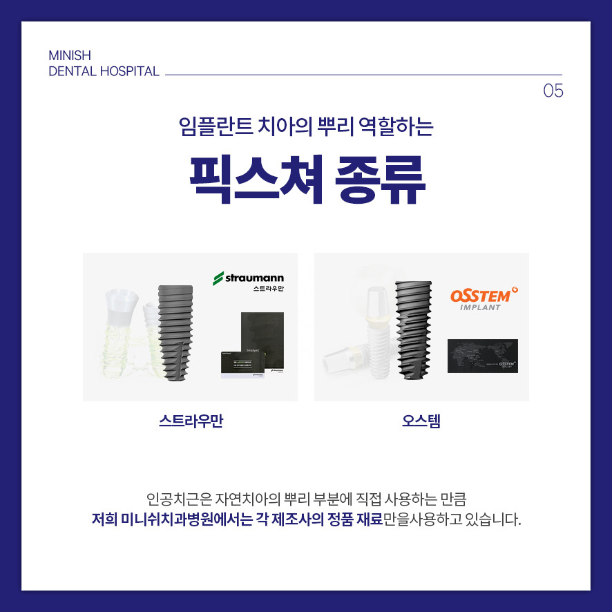 '임플란트'의 거의 모든 것 관련 이미지 9