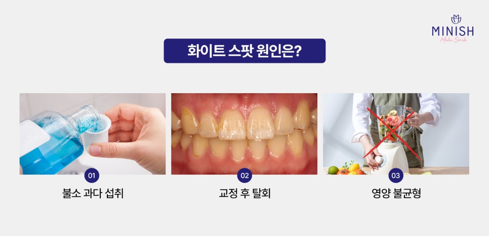 White Spots: Improve Stained Teeth Naturally with Minish! image 3
