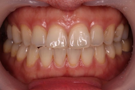 A 6-Year Minish Review from a Dentist, feat. Director Lee Jeong-eun image 2