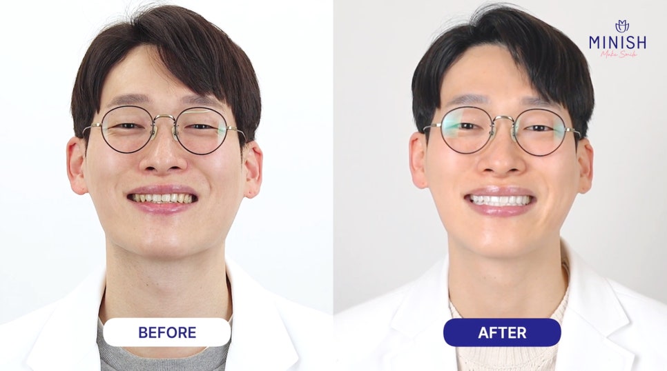 Minish Review by Dentist and Chief Director Kwak Hae-seong: “I Came to Understand the Patient’s Perspective Better” image 4