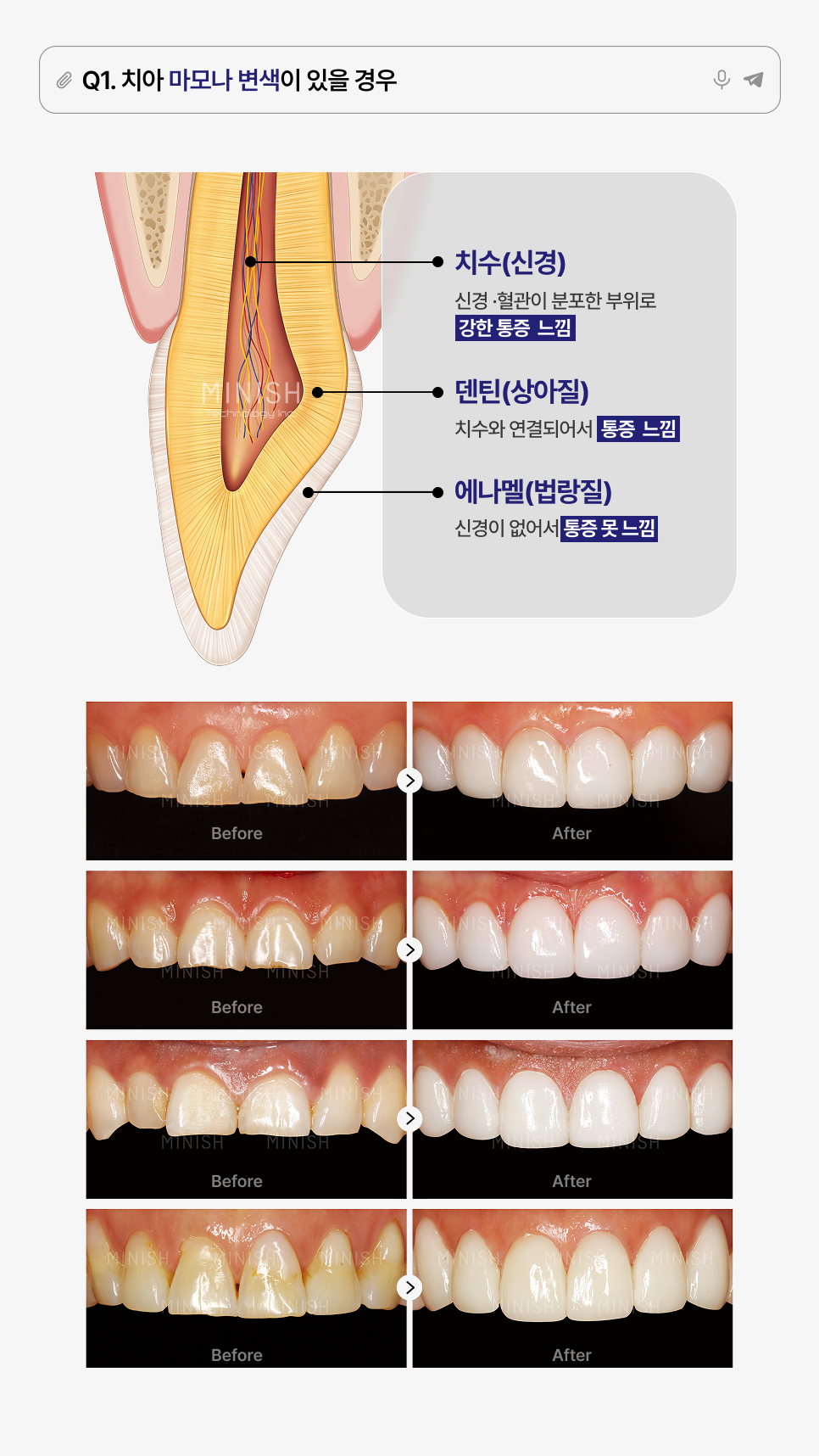 Minish Questions: The Six Most Frequently Asked Questions! image 2