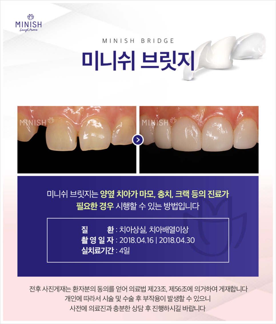 재미로 보는 치아 관상, 과연 내 치아는? 관련 이미지 4