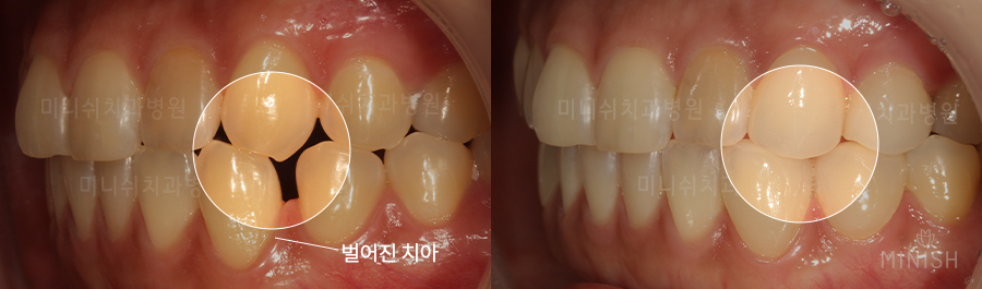 꽃게엄마와 꽃게딸, 미니쉬로 찾은 행복한 미소 [엄마는예뻤다] 관련 이미지 11