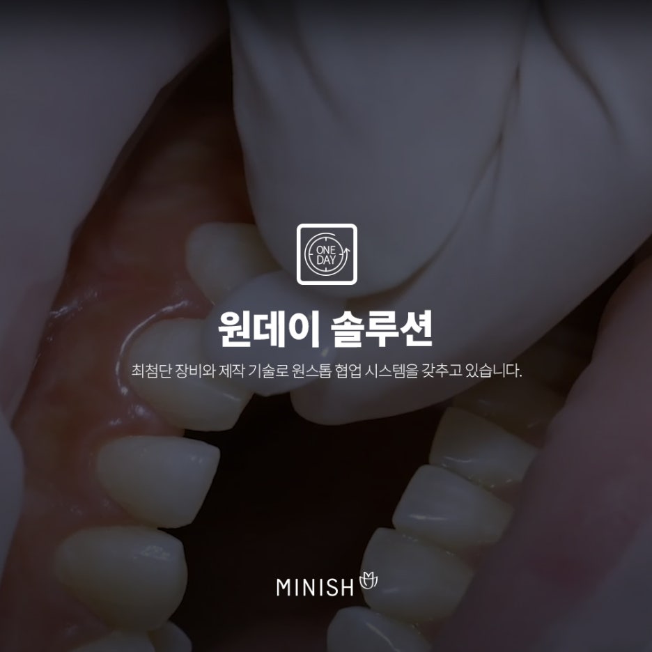 뻐드렁니, 덧니! 치아틀어짐 하루만에 해결하는 미니쉬가격은? 관련 이미지 4