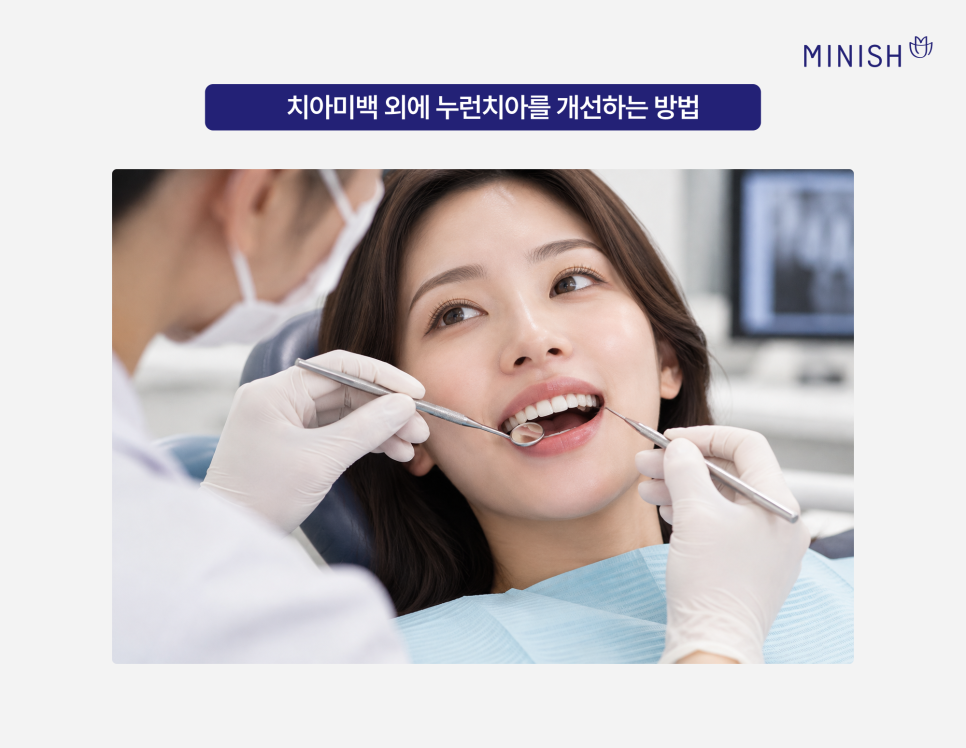 치아미백으로 해결 안 되는 누런치아, 하얗게 하려면? 관련 이미지 4