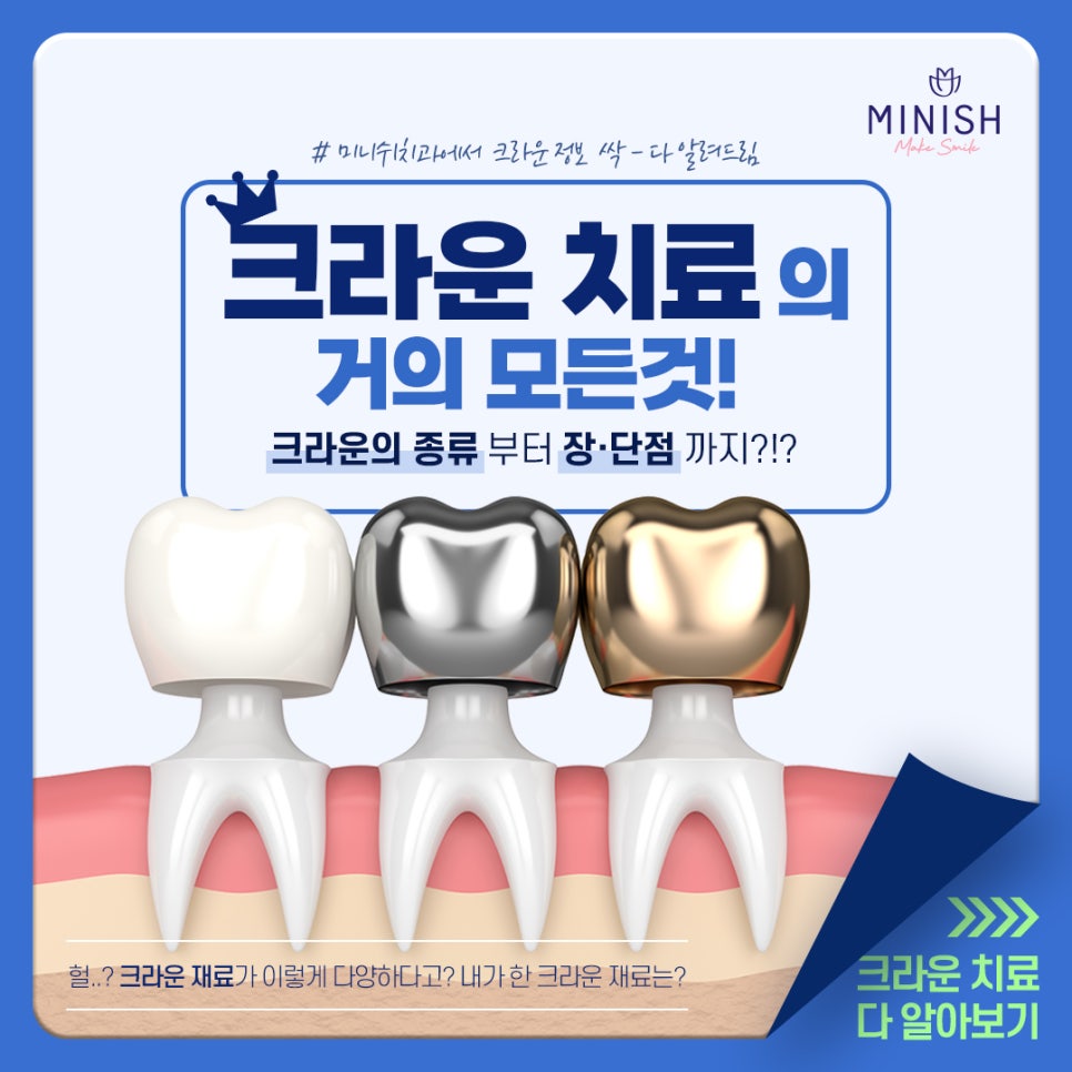 크라운치료의 거의 모든 것 관련 이미지 1
