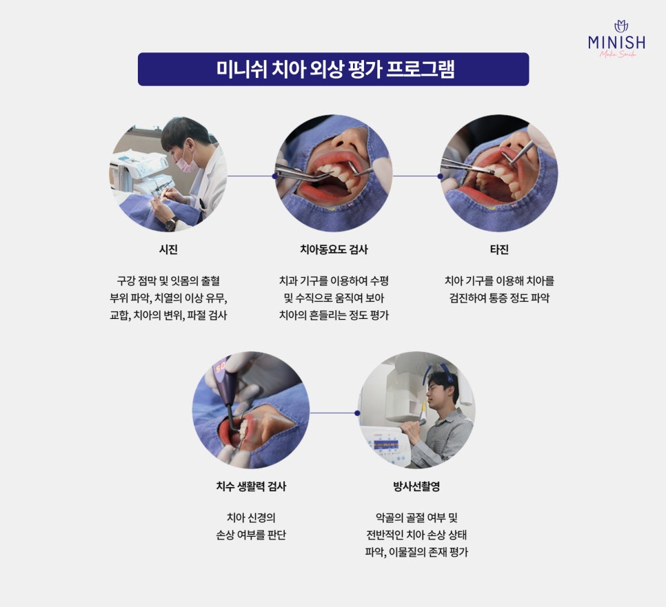 Hakdong Station Dental Clinic: Broken Teeth and Tooth Fracture Treatment — How Long Is the Golden Time? image 7