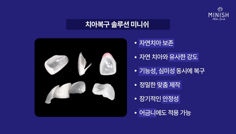 What If a Tooth Breaks? A Complete Summary of Tooth Fracture Treatment Methods and Their Pros and Cons image 4