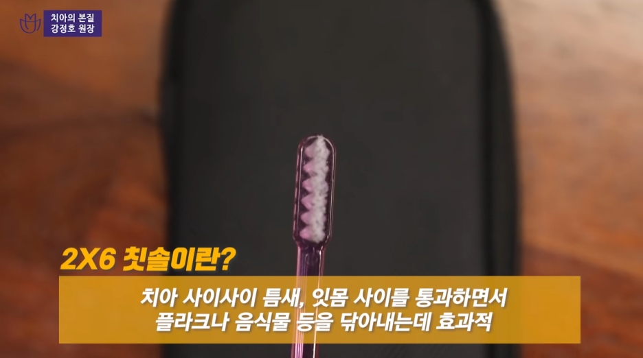 잇몸염증은 구강 적신호...가장 적극적인 잇몸치료는 미니쉬 관련 이미지 24