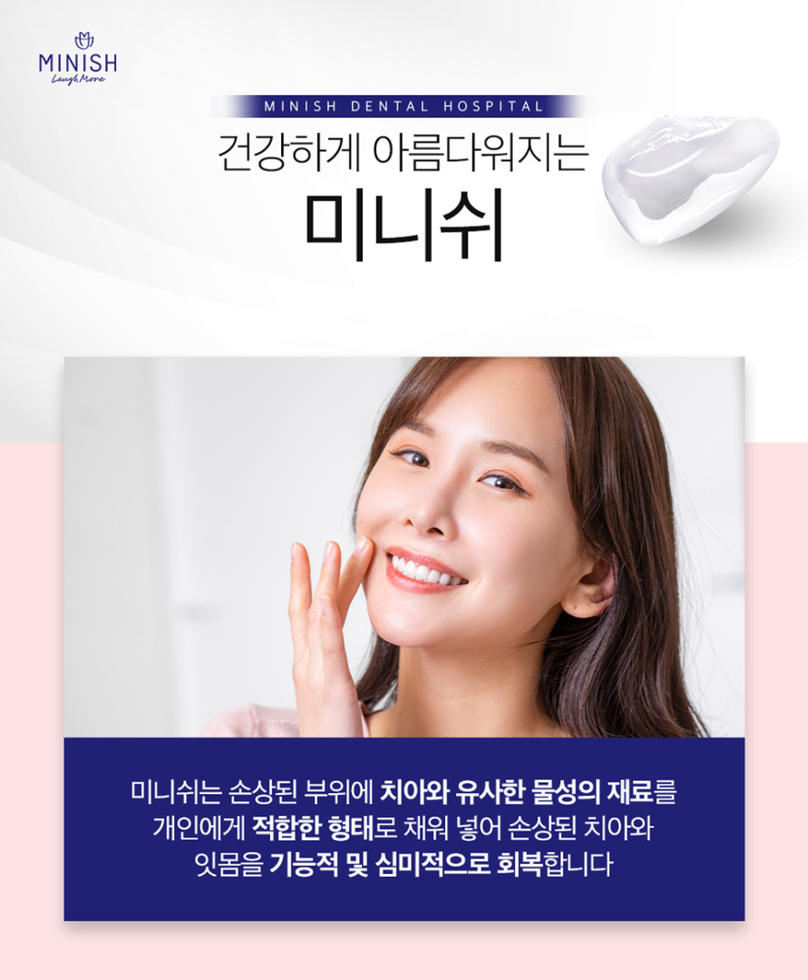 압구정치과 손상된 치아 기능과 심미성을 동시에 높여주는 미니쉬 관련 이미지 1