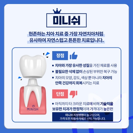 크라운치료의 거의 모든 것 관련 이미지 10