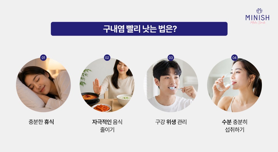 구내염 원인부터 빨리 낫는 법까지, 자꾸 생기는 이유는? 관련 이미지 4