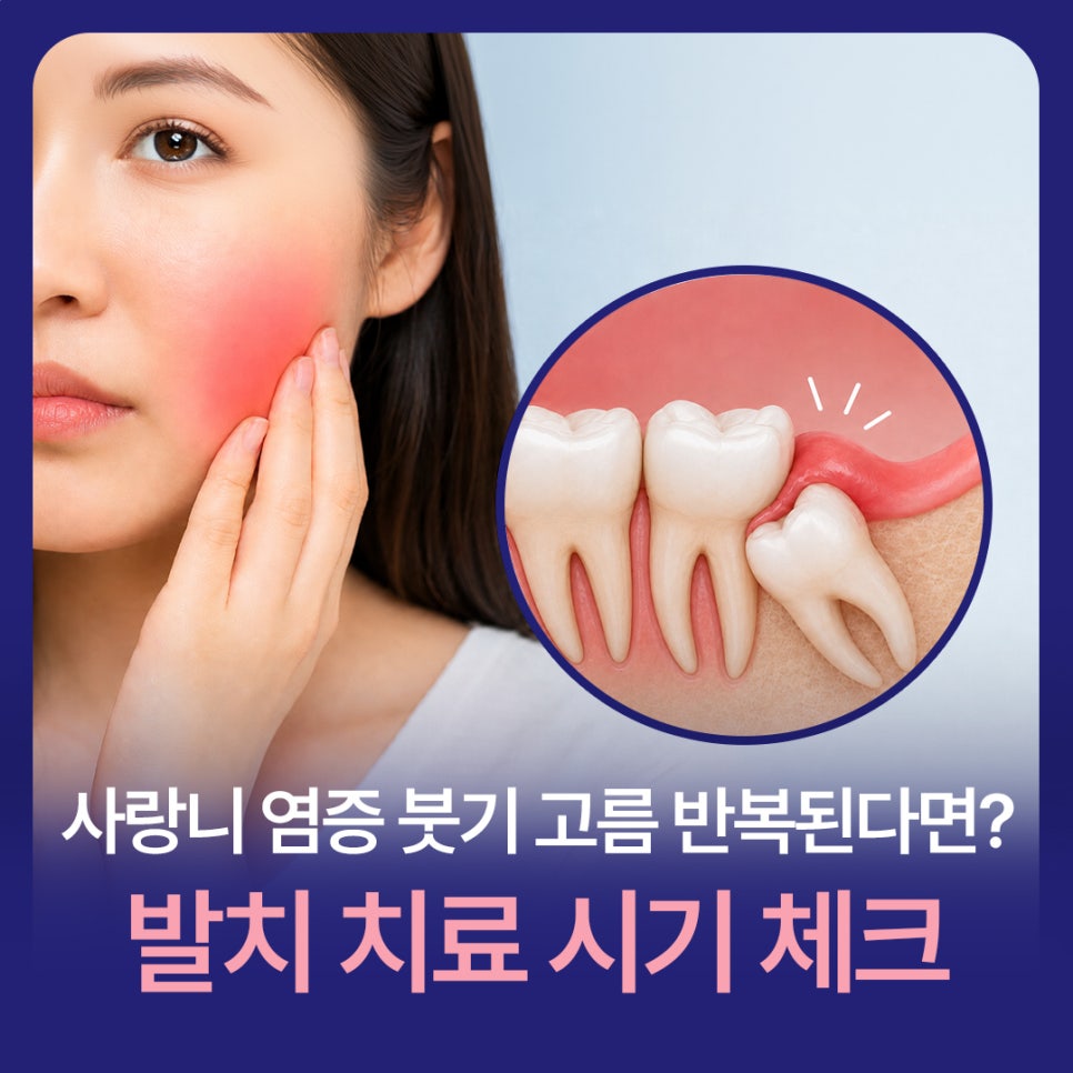 사랑니 염증 붓기 고름 반복된다면? 발치 치료 시기 체크 관련 이미지 1