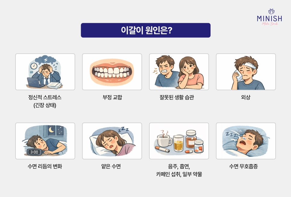 If you leave teeth grinding untreated, it can even cause tooth cracks image 2