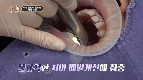 가평엄마 아들의 결손치, 미니쉬로 복원! [엄마는 예뻤다] 관련 이미지 9
